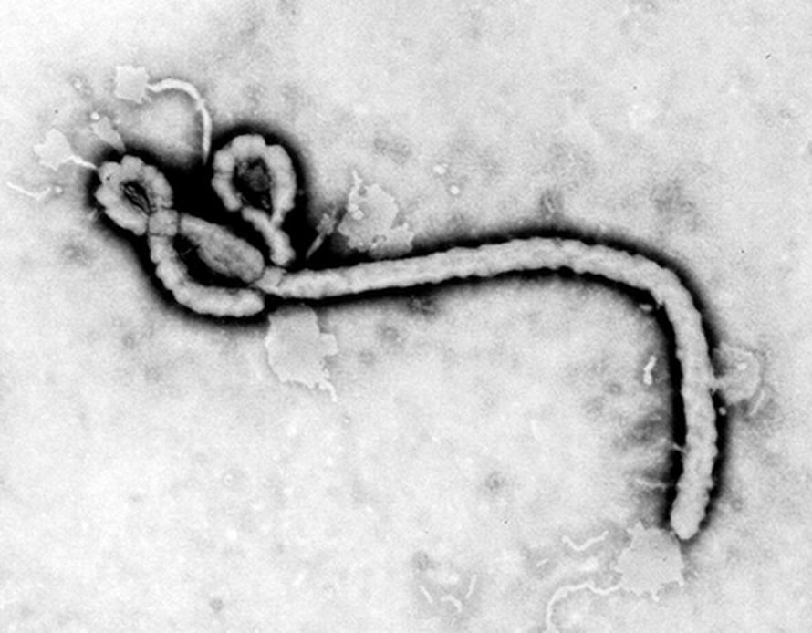 Ebola-virus (kuva: CDC).