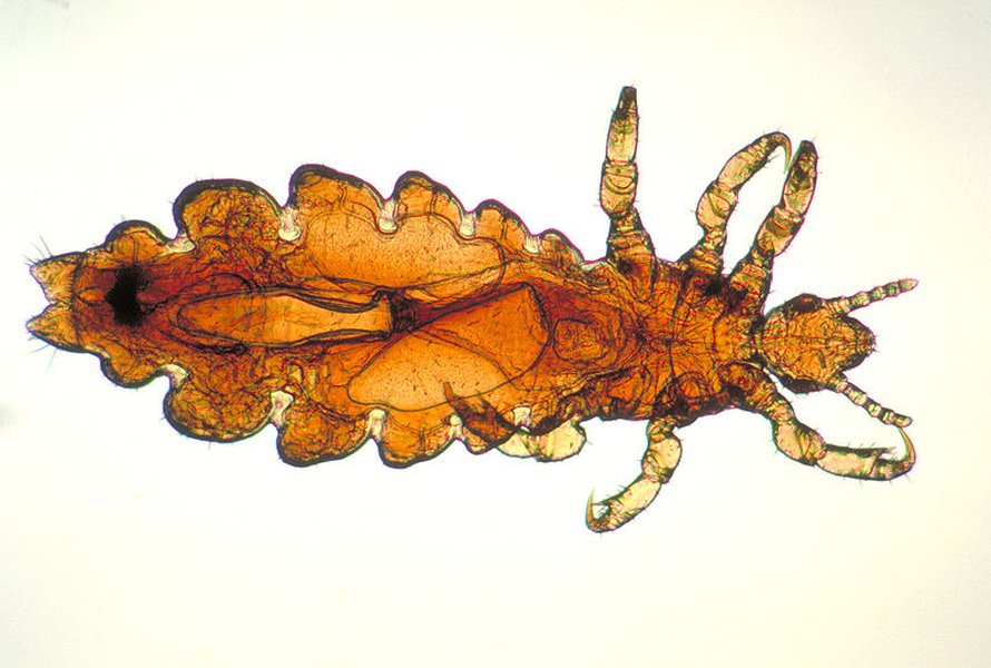 Päätäi (Pediculus humanus). Kuva: <span class="photographer">Dennis D. Juranek/CDC</span>