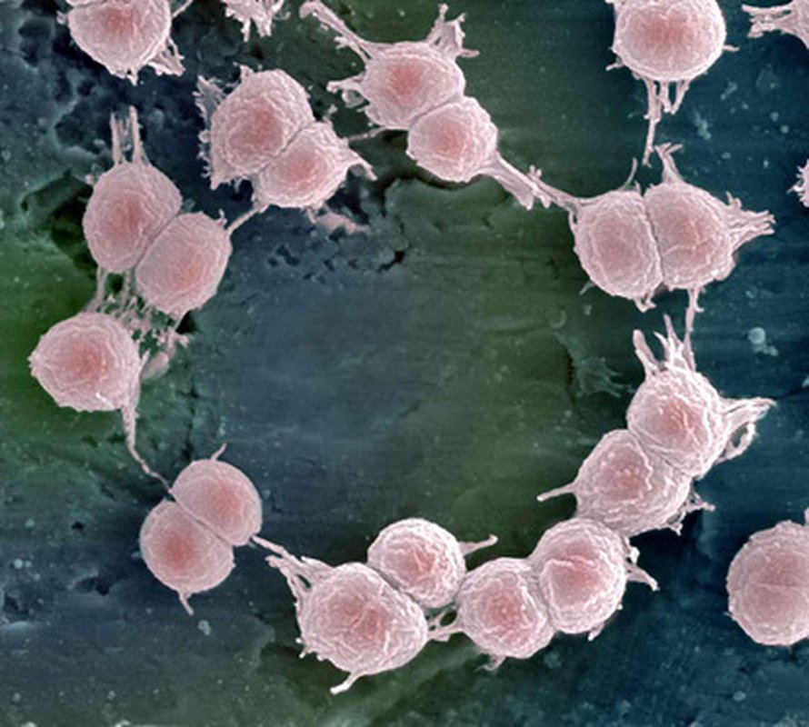 Deinococcus geothermalis. Kuva: <span class="photographer">Raija Peura/Oulun yliopisto Elektronioptiikan laitos</span>