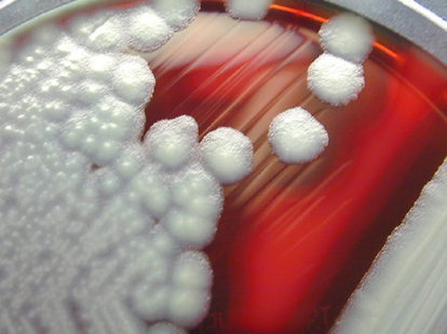 Cereusbakteereja verimaljalla (Kuva: <span class="photographer">CDC/Larry Stauffer/Oregon State Public Health Laboratory).</span>