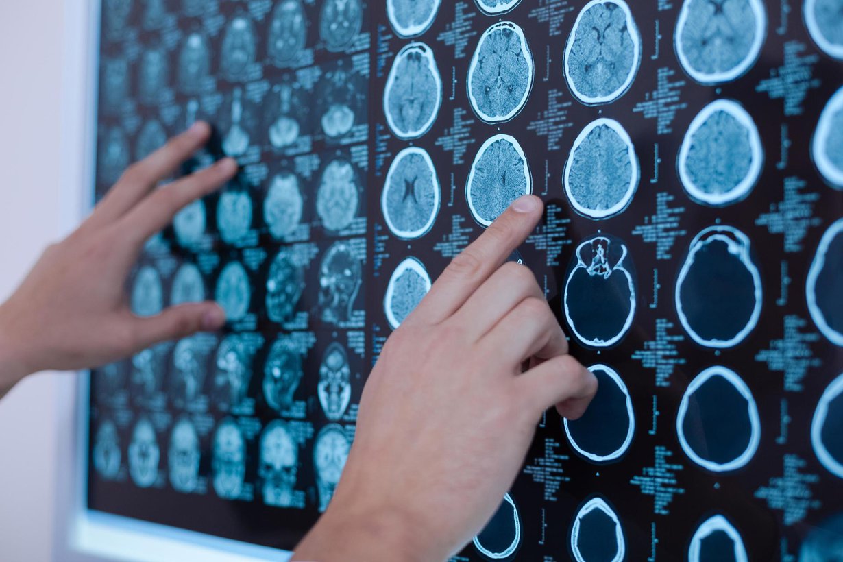 85-prosentin sääntö voi kuvata sitä, miten radiologi oppii tulkitsemaan tietokonekuvia ihmisen kudoksista. Kuva: Shutterstock