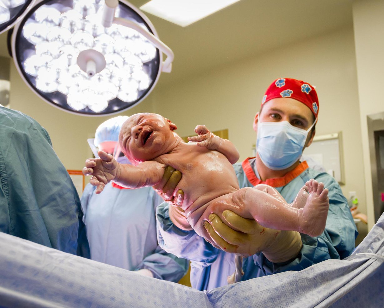 Keisarileikkauksessa äidin hyödyllistä mikrobistoa ei siirry lapselle samassa määrin kuin alatiesynnytyksessä. Kuva: Shutterstock