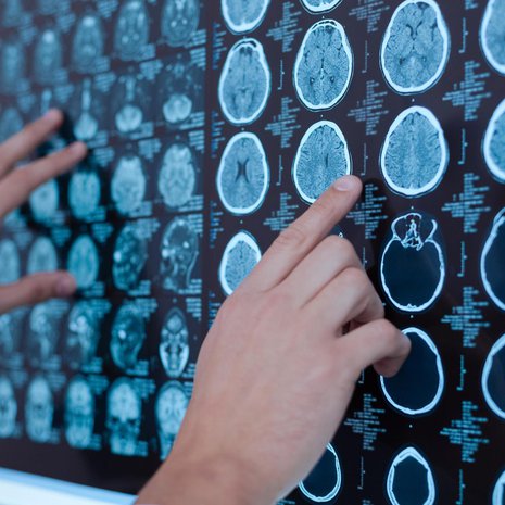 85-prosentin sääntö voi kuvata sitä, miten radiologi oppii tulkitsemaan tietokonekuvia ihmisen kudoksista. Kuva: <span class="photographer">Shutterstock</span>