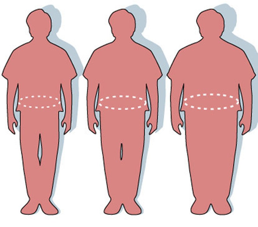 Normaali, ylipainoinen ja liikalihava mies. Kuva: <span class="photographer"><A HREF=http://en.wikipedia.org/wiki/File:Obesity-waist_circumference.PNG>Wikimedia Commons</A></span>
