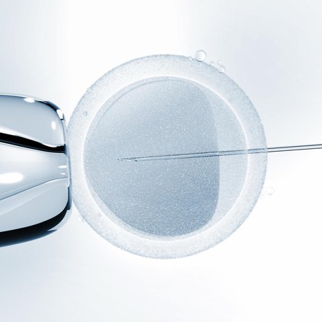 Mikroskoopikuvassa näkyy keinohedelmöitys. Genomic Prediction -yrityksen geenitesti otettaisiin keinohedelmöitetystä alkiosta. Kuva: <span class="photographer">Shutterstock</span>