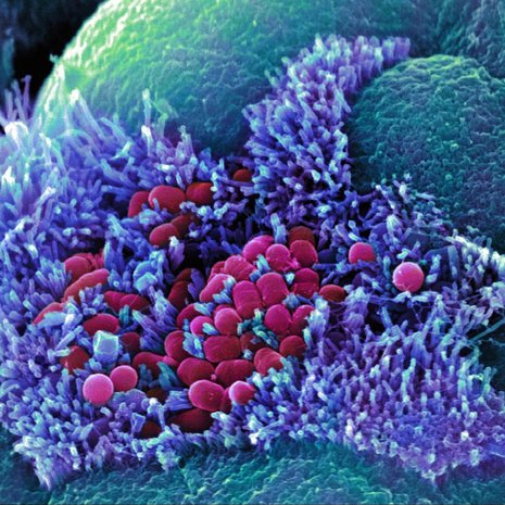 Escherichia coli on yksi enterobakteereista, jonka katsotaan ennustavan kantajansa terveydellisiä riskejä. Kuva: <span class="photographer">STEPHANIE SCHULLER/SCIENCE PHOTO LIBRARY</span>