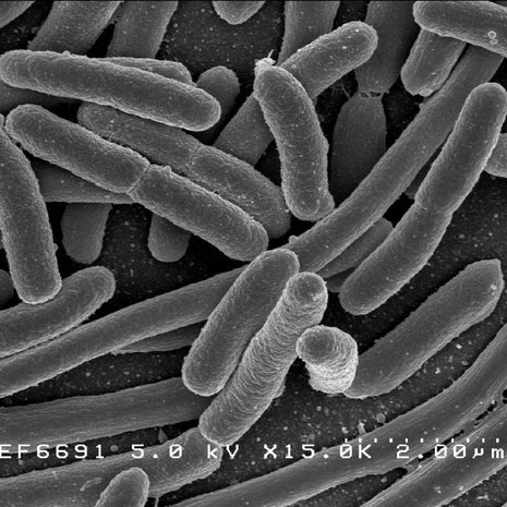 Superbakteerigeeni löytyi E.coli- bakteerista, joka eristettiin erään tulehduksesta kärsineen diabeetikon elimistöstä.