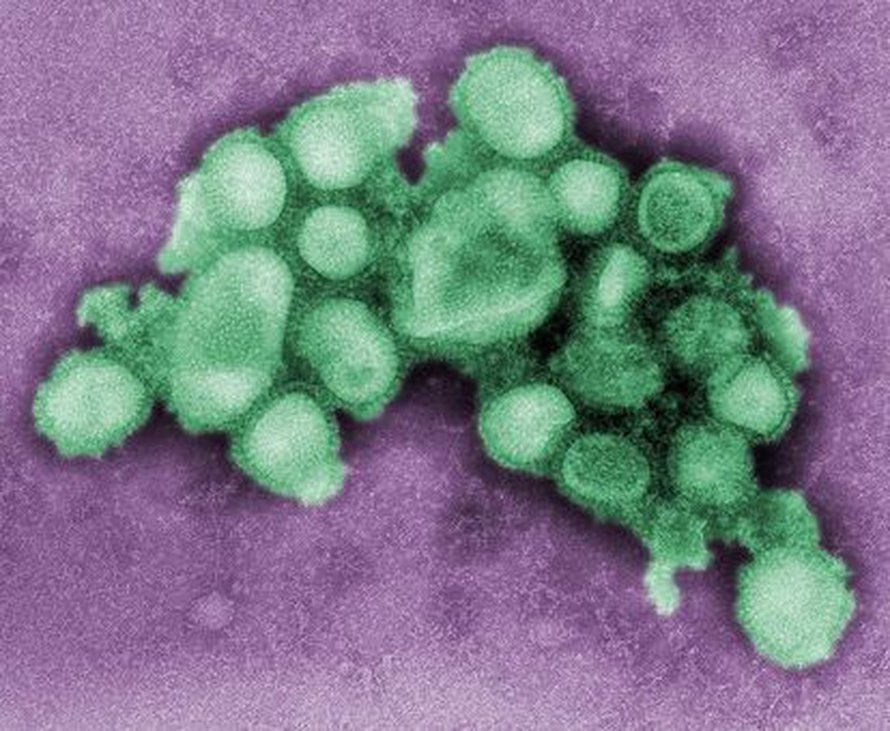 Uutta H1N1-virusta. Kuva: <span class="photographer">C. S. Goldsmith and A. Balish, Centers for Disease Control and Prevention</span>