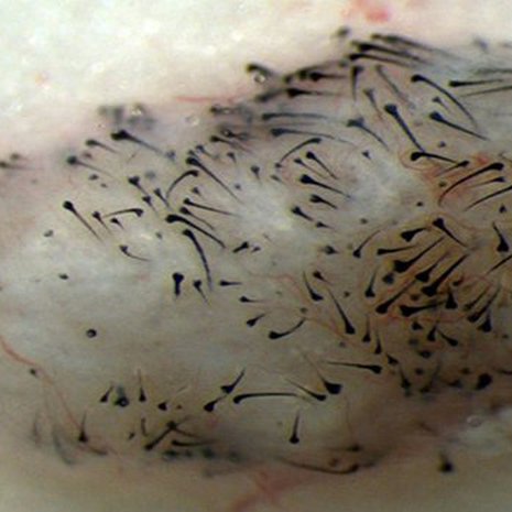 Hiusta pantiin kasvamaan hiiren ihokudoksesta. Kuva: <span class="photographer">Sanford-Burnham Medical Research Institute</span>
