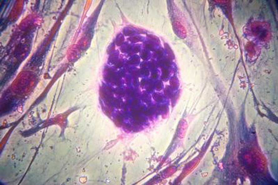 Kantasoluja. Kuva: <span class="photographer">M. William Lensch / Harvard Medical School/Science-AAAS.</span>
