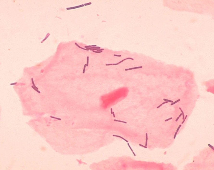 Lactobacillus on yksi tyypillisimpiä ihon limakalvon suojaavia bakteereita. Kuva Janice Carr / CDC
