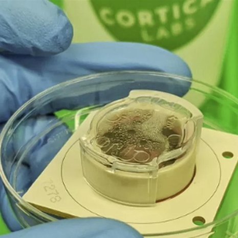 Elatusmaljassa kasvatettiin noin 800000 aivosolua mikropiirien päällä. Kuva: <span class="photographer">Cortical Labs</span>