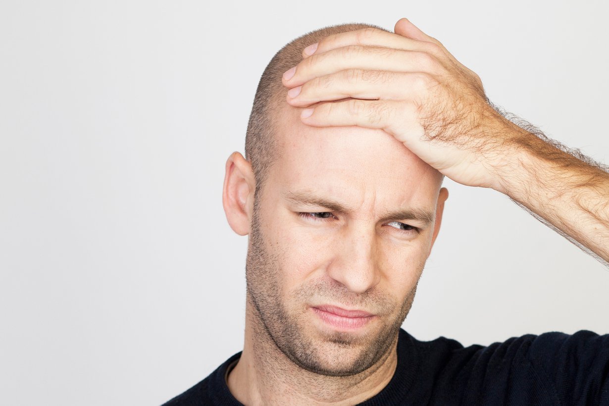 Vähäkarvaisuudesta voisi sakottaa: sänkitukasta hitusen, kaljusta täysi vero. Kuva: Shutterstock