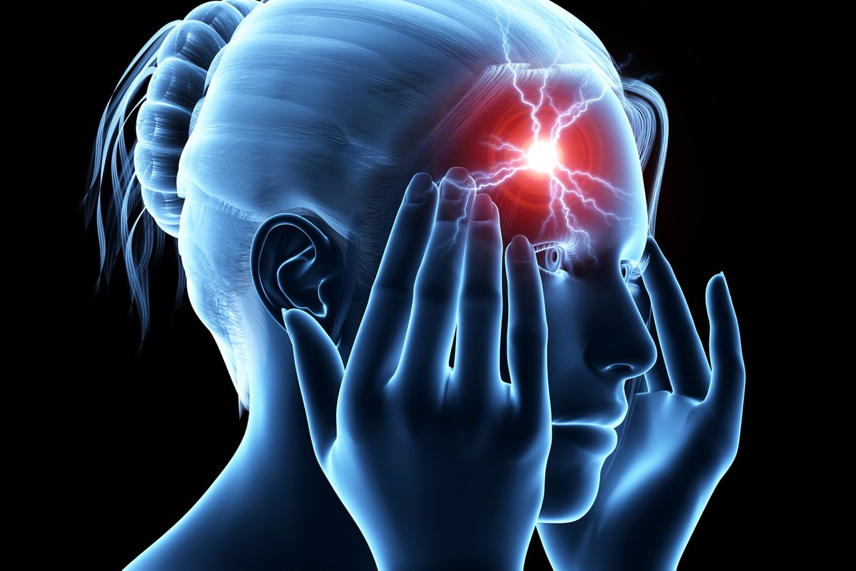 Rajuimmillaan sähköhäiriö ärsyttää koko keskushermoston hälytystilaan. Kuva: Shutterstock