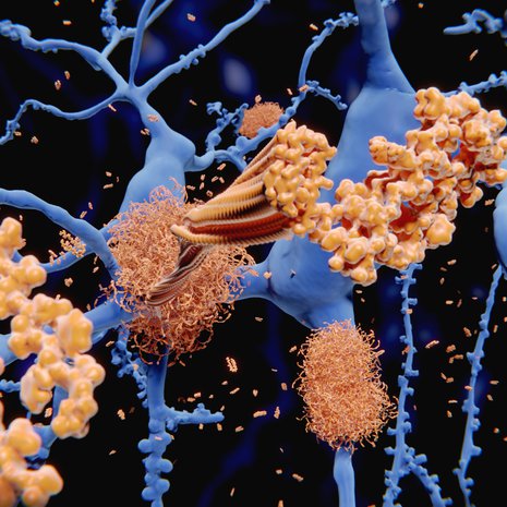 Alzheimerin tauti kerryttää. Kuva: <span class="photographer">Getty Images</span>