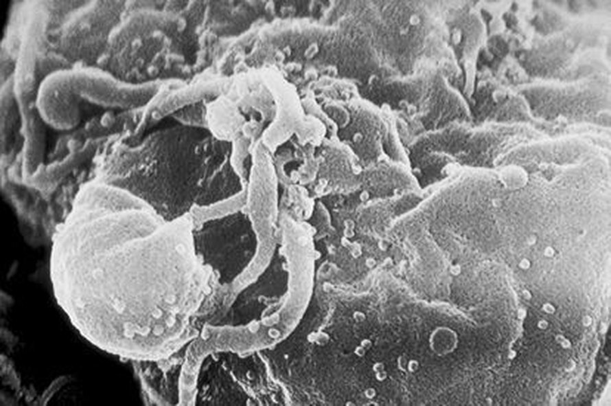 Uusi HI-virus vapautumassa infektoituneesta T-solusta. Kuva: <span class="photographer">C. Goldsmith</span>
