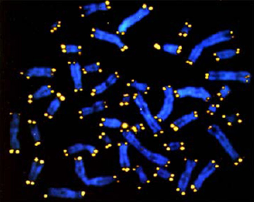 Kromosomien (sininen) päät on suojattu telomeeritupein (keltainen), joita kunnostetaan telomeraasilla.
