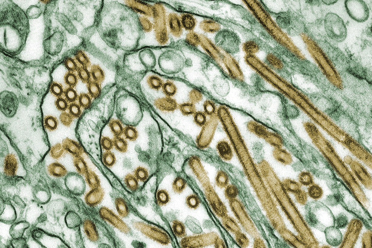 Lintuvirus tarrautuu hengitysteiden limakalvoihin hemagglutiinimolekyyleillä. Nykyisen luonnonkannan molekyylit sopivat kuitenkin huonosti ihmissolujen virussieppareihin. Kuva: Gynthia Goldsmith/CDC