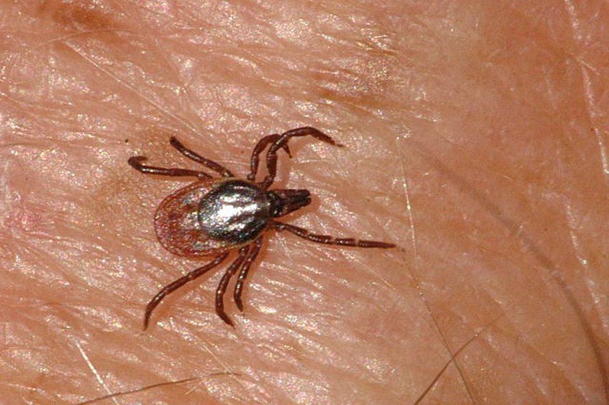Puutiainen ihmisen iholla. Kuva: <span class="photographer">James Lindsey / Wikimedia Commons</span>