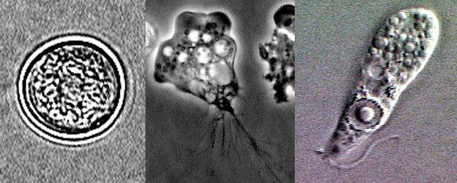 Naegleria fowlerin erilaisia muotoja. Kuva: <span class="photographer">Yhdysvaltain tartuntatautivirasto</span>