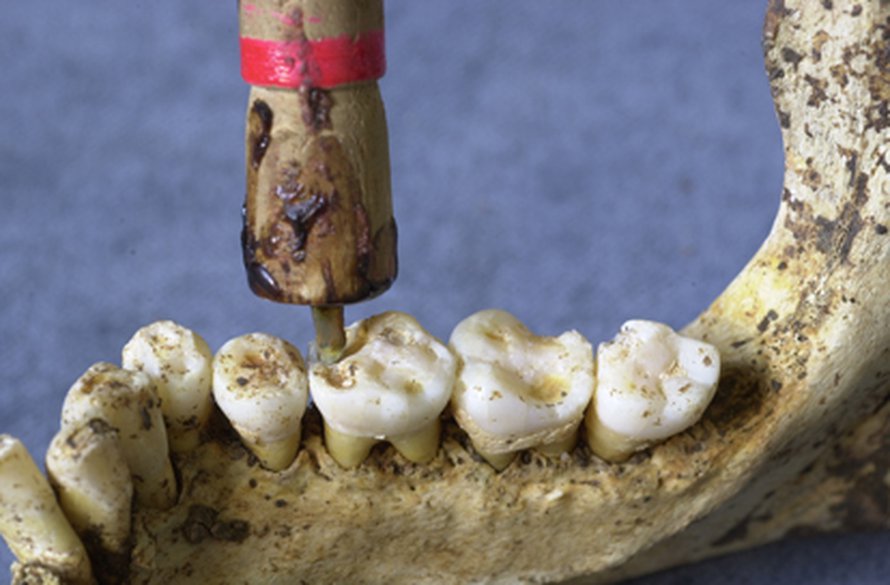 Kuva: <span class="photographer">L. Bondioli, Museum L. Pigorini of Rome, & R. Macchiarelli, Univ. of Poitiers</span>