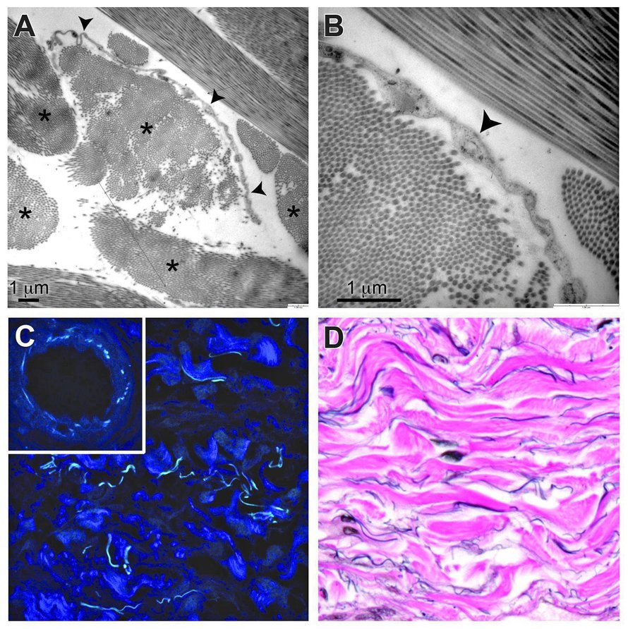 Uudella kuvaustekniikalla solujen välinen interstitium eli välikudos näyttäytyi erilaisena kuin ennen. Kuva: <span class="photographer">Scientific Reports, Neil Theise, David Carr-Locke</span>