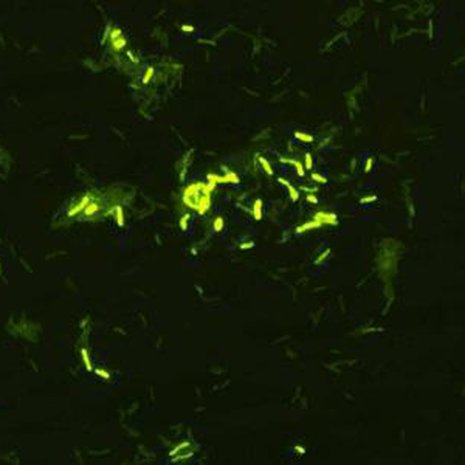 Mullassa lymyilevä Mycobacterium vaccae buustaa vastustuskykyä. Kuva: <span class="photographer">Christopher Lowry</span>