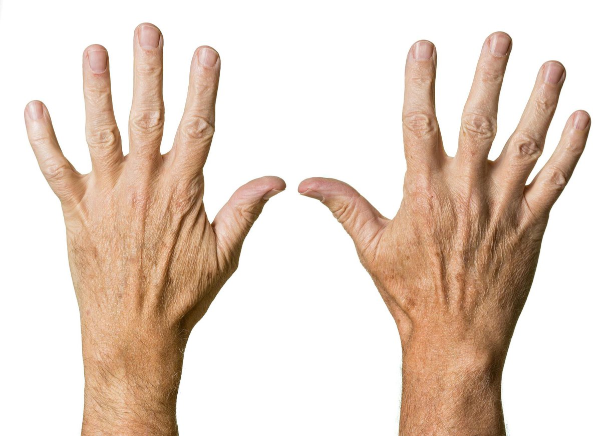 Kantasolukokeessa nuorentuneet ihosolut tuottivat enemmän kollageenia. Kuva: Shutterstock