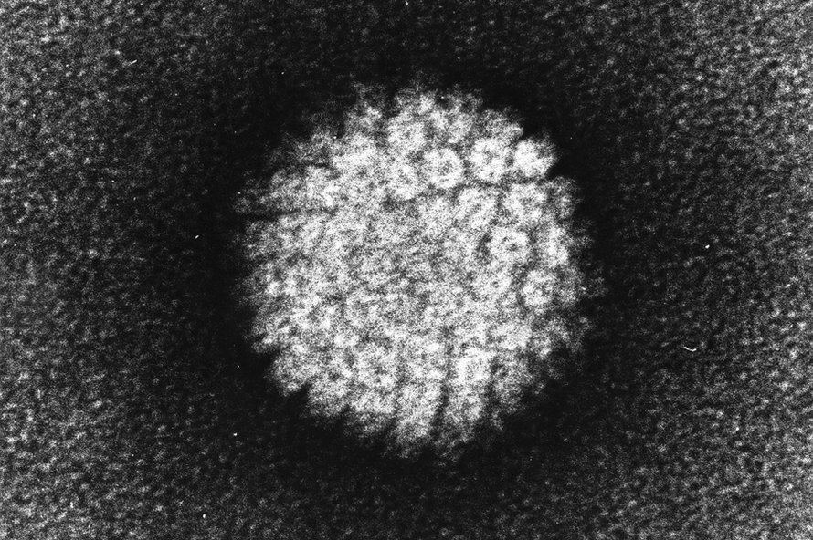 Kuva: <span class="photographer">NIH / Laboratory of Tumor Virus Biology</span>
