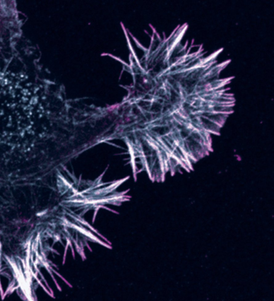 Filopodit haravoivat ympäristöä, kunnes kohtaavat oikean reseptorin. Kuva: <span class="photographer">Catherine Galbraith and James Galbraith / National Institutes of Health
</span>