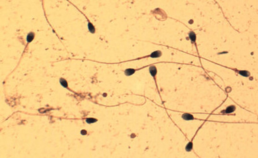 Kuva: <span class="photographer">Corbis RF.</span>