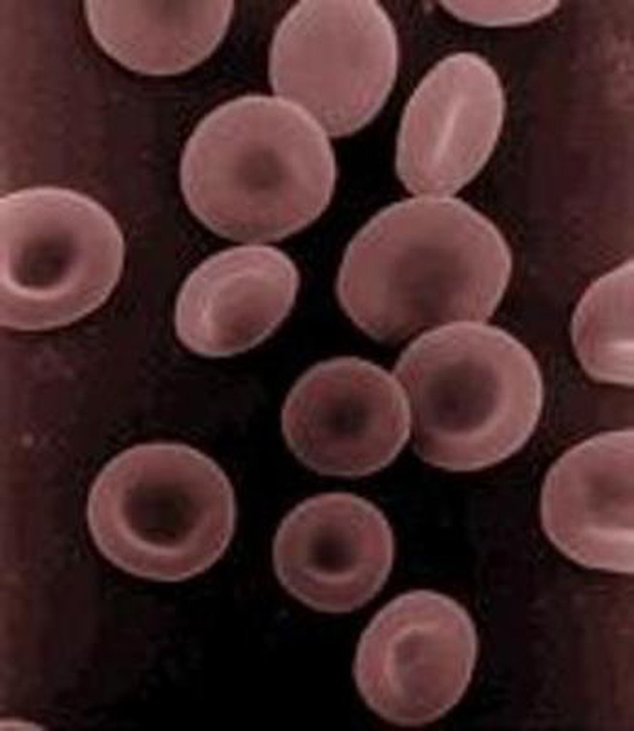 Punasoluja. Kuva: <span class="photographer">NIH</span>
