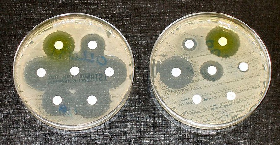 Kaksi eri E. coli -kantaa, joista vasemmanpuolinen on herkkä kaikille antibiooteille ja oikeanpuolinen on resistenssi muutamille antibiooteille. Kuva: <span class="photographer">Graham Beards / Wikimedia Commons.</span>