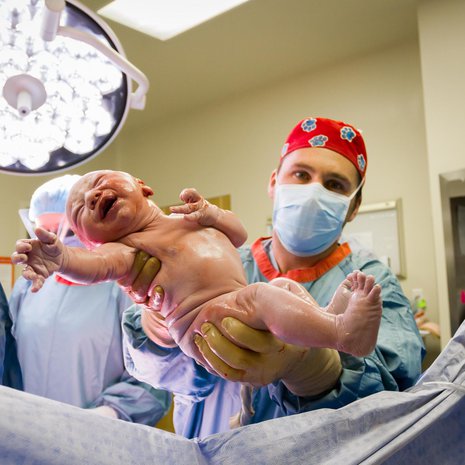 Keisarileikkauksessa äidin hyödyllistä mikrobistoa ei siirry lapselle samassa määrin kuin alatiesynnytyksessä. Kuva: <span class="photographer">Shutterstock</span>