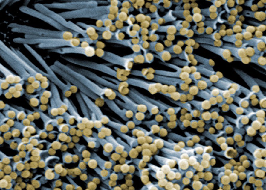 Nanokoeputkia. Kuva: <span class="photographer">University of Florida</span>