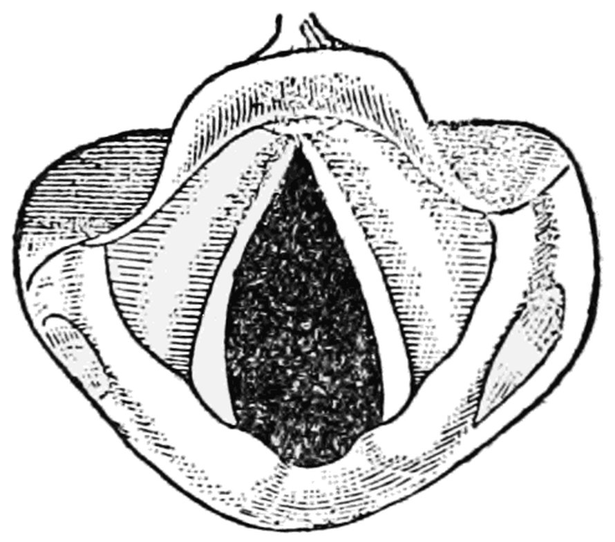 Ihmisen avoinna olevat äänihuulet. Kuva: <span class="photographer">Popular Science Monthly, Wikimedia Commons</span>