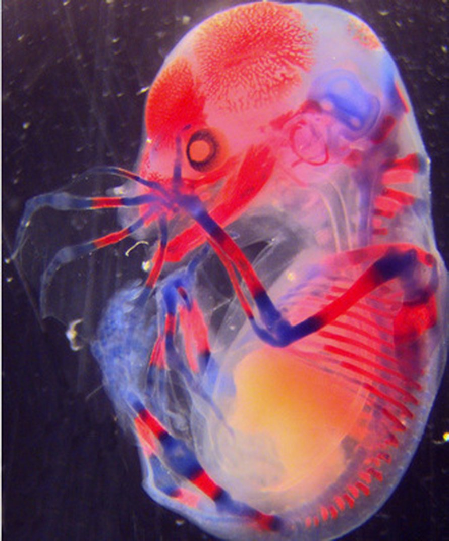 80 päivän ikäinen lepakon sikiö kasvattaa sormiluitaan. Kuva: <span class="photographer">Scott Weatherbee/Memorial Sloane Kettering Cancer Center.</span>