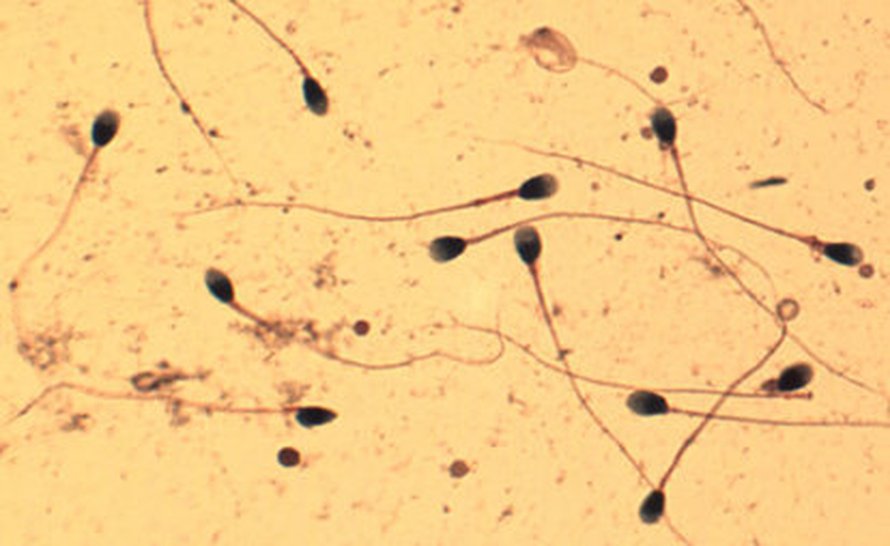 Kuva: <span class="photographer">Corbis RF.</span>