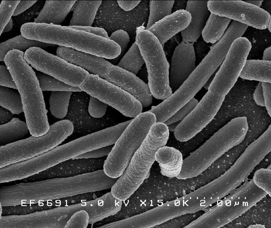 Superbakteerigeeni löytyi E.coli- bakteerista, joka eristettiin erään tulehduksesta kärsineen diabeetikon elimistöstä.