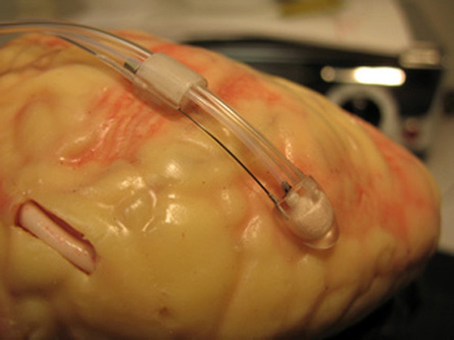 HeartLander. Kuva: <span class="photographer">Nick Patronik, Carnegie Mellon University</span>