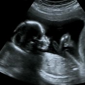 Neljän kuukauden ikäinen sikiö ultraäänikuvassa. Kuva: <span class="photographer">Shutterstock</span>