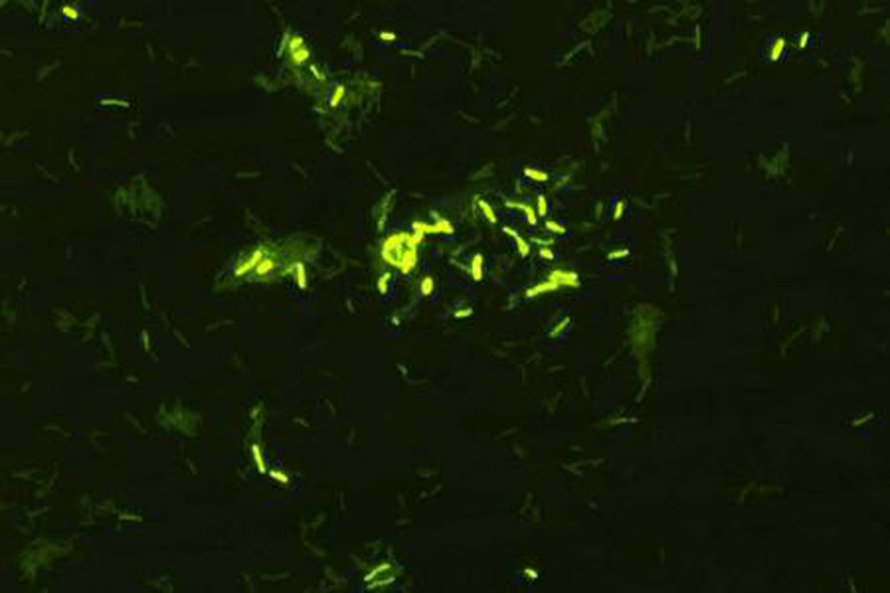 Mullassa lymyilevä Mycobacterium vaccae buustaa vastustuskykyä. Kuva: <span class="photographer">Christopher Lowry</span>