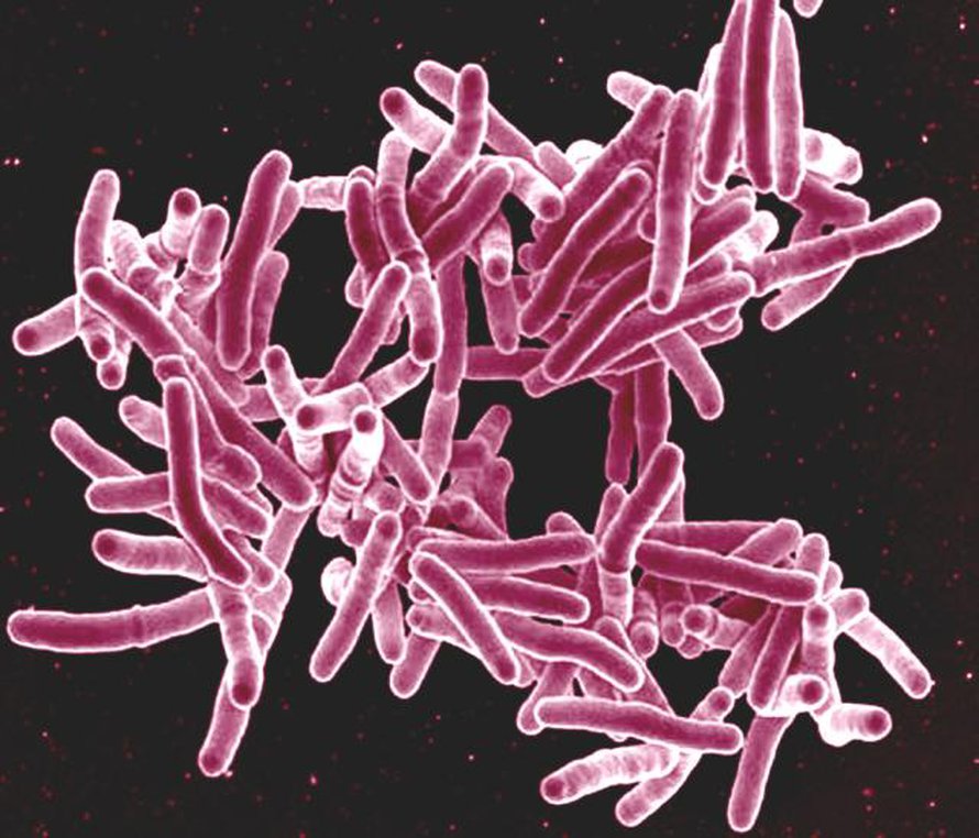 Tuberkuloosin aiheuttava Mycobacterium tuberculosis -bakteeri. Kuva: <span class="photographer">NIAID / Wikimedia Commons</span>