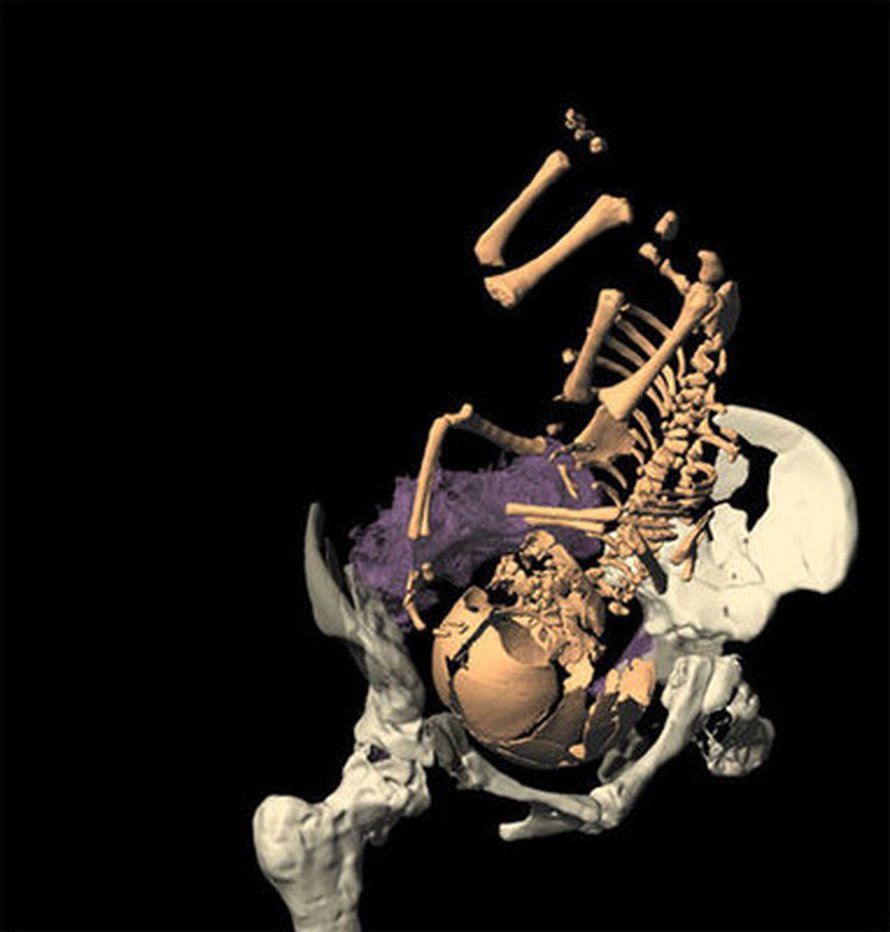 Simulointi osoitti, että neandertalilaissynnytys oli yhtä vaikea kuin nykyihmisen. Kuva: <span class="photographer">M. Ponce de León and C. Zollikofer, University of Zurich.
</span>