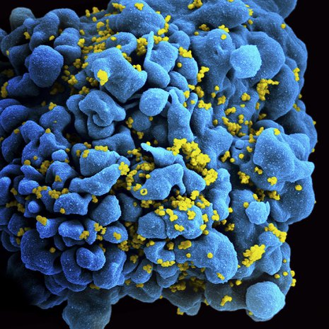 Hiv-virusta T-solussa. Kuva: <span class="photographer">National Institutes of Health/Stocktrek Images</span>