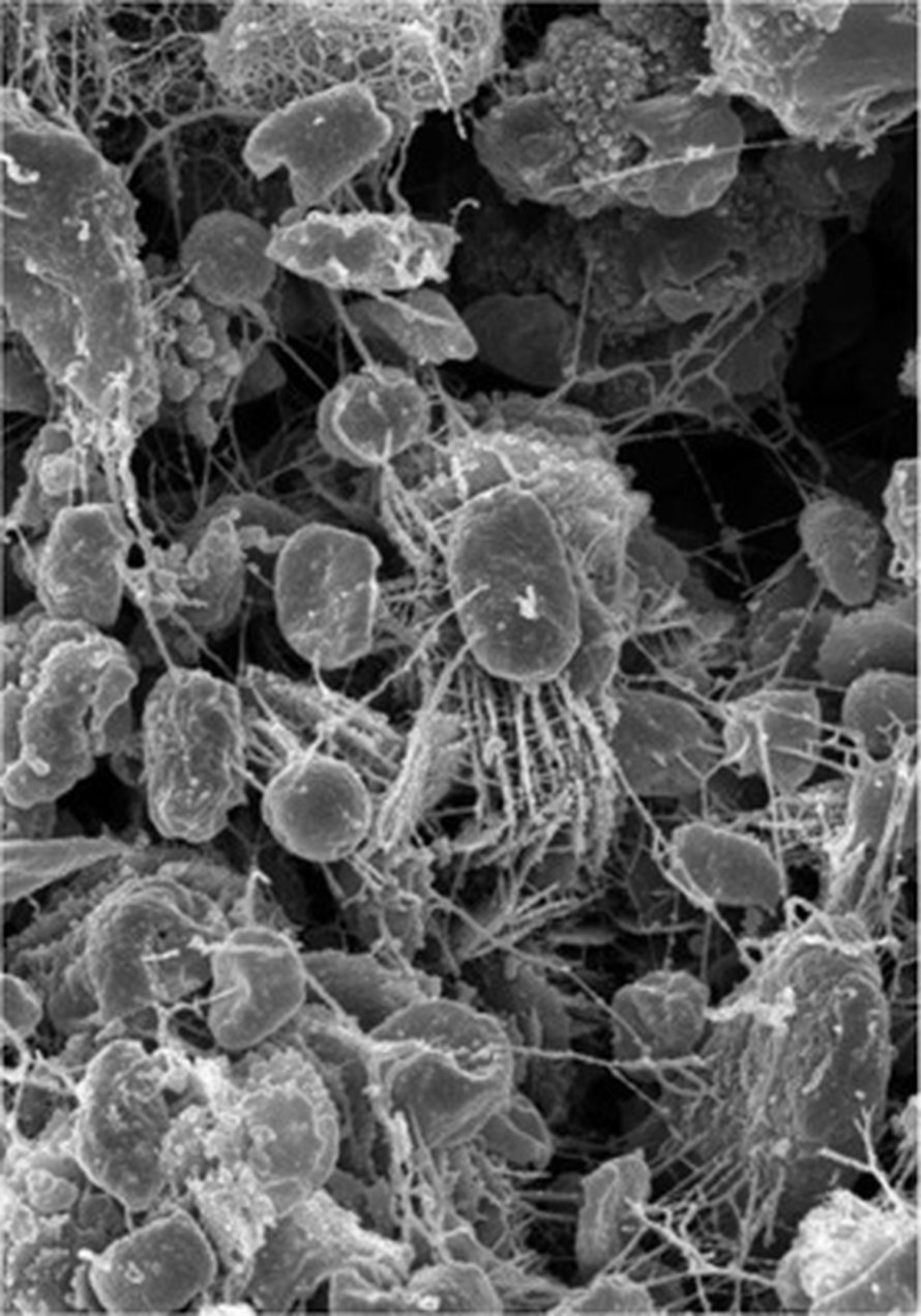 Pakkasessa eläviä ja lisääntyviä bakteereita saattaa löytyä Maan ulkopuolelta. Kuva: <span class="photographer">Maryland Astrobiology Consortium, NASA, and STScI
</span>
