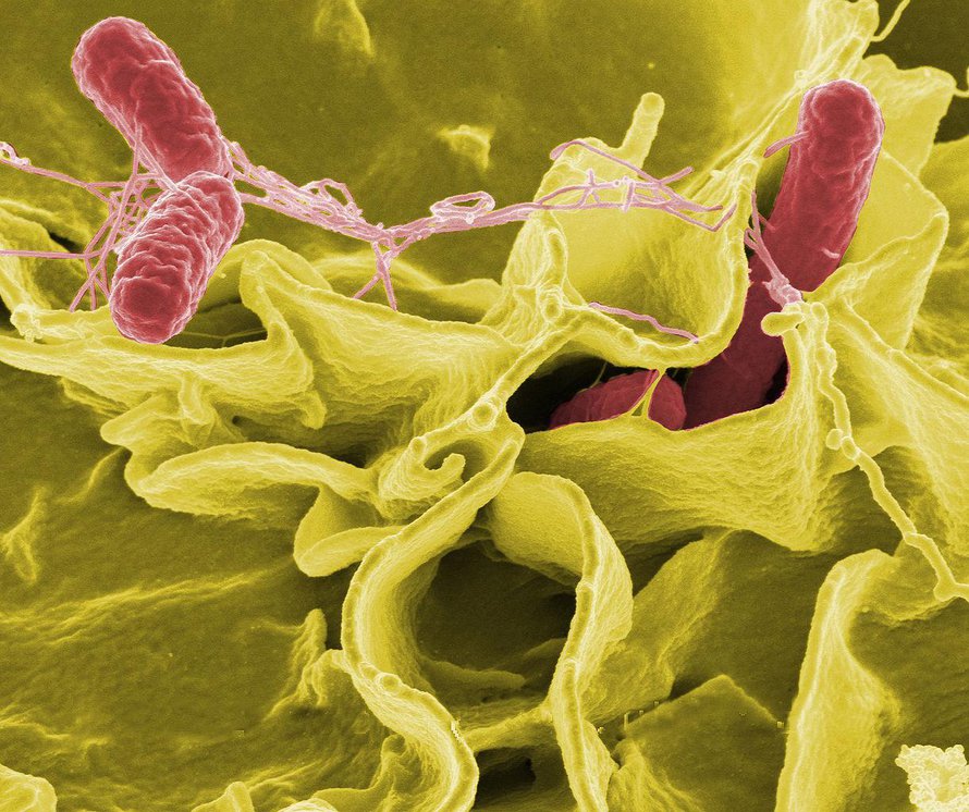 Kuvassa punaiseksi värjätty Salmonella Typhimurium tunkeutuu ihmisen soluun. Kuva: <span class="photographer">NIAID</span>