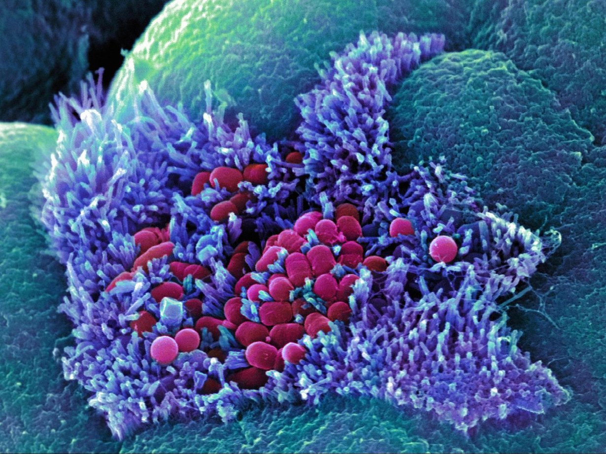 Escherichia coli on yksi enterobakteereista, jonka katsotaan ennustavan kantajansa terveydellisiä riskejä. Kuva: STEPHANIE SCHULLER/SCIENCE PHOTO LIBRARY