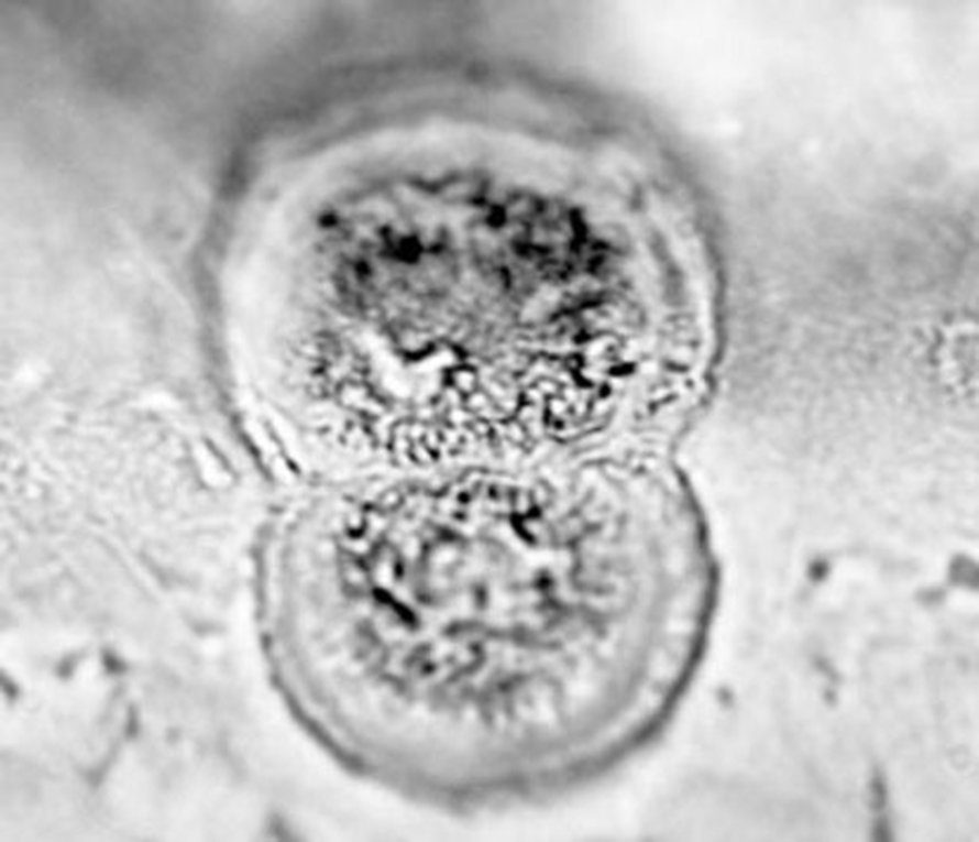 Nykyistä Cosmarium-korulevää muistuttava triaskauden levä. Kuva: <span class="photographer">Guido Roghi.</span>
