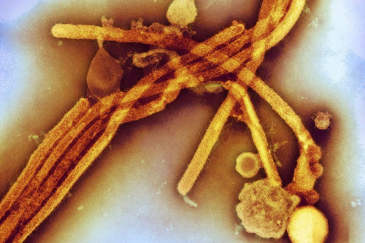 H3N2 alkoi kiertää maailmaa 1968. Silloin se aiheutti superinfluenssan, joka tappoi 700 000 ihmistä. Kuva: MVPhotos / SPL